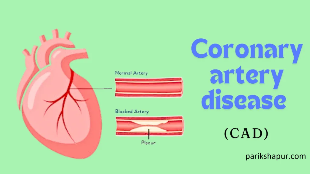 Coronary artery disease (CAD)