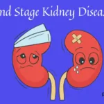 End Stage Kidney Disease