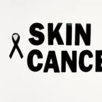 SKIN CANCER